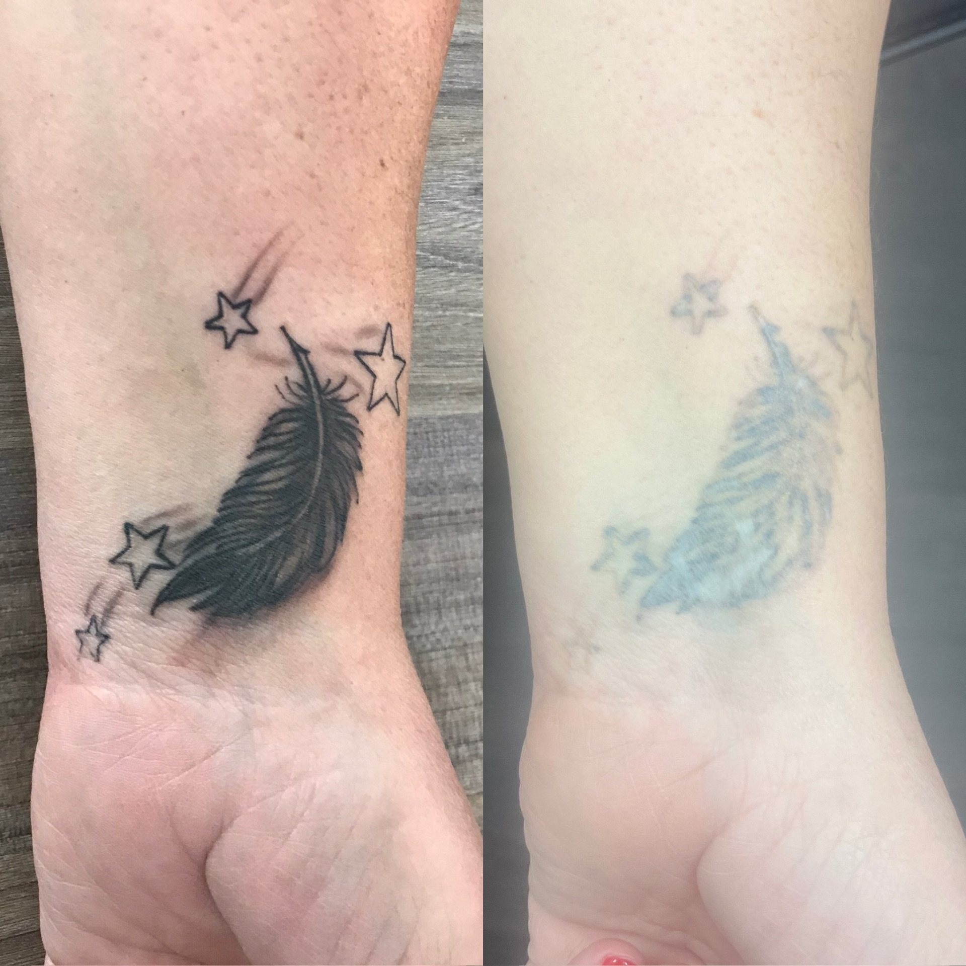 Before and after of a feather and stars wrist tattoo lightened by laser.